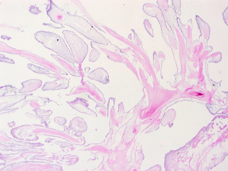 Pathology Image
